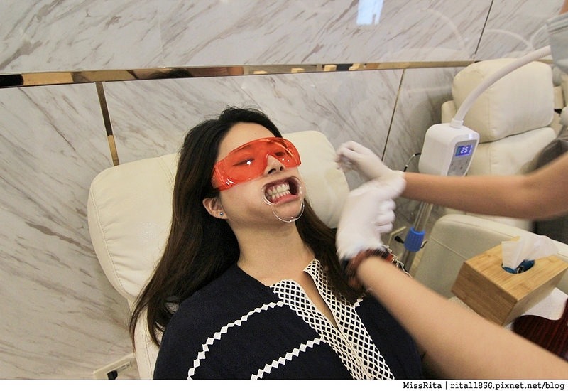 Dr.Min美齒專家 台中美白牙齒 美白牙齒 美齒專家 牙齒美白推薦7