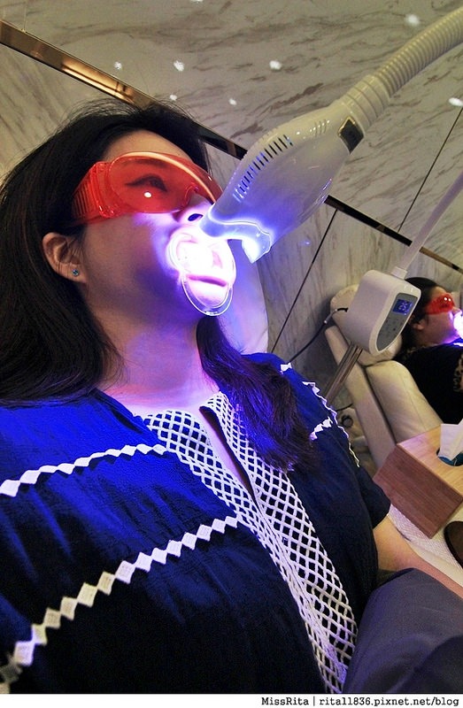 Dr.Min美齒專家 台中美白牙齒 美白牙齒 美齒專家 牙齒美白推薦5